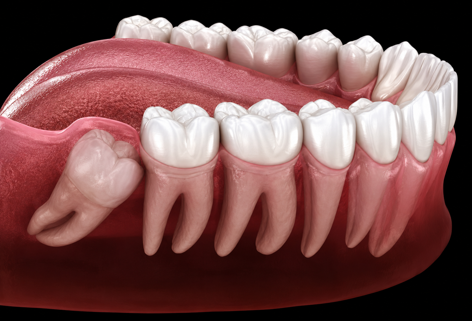 Minor Oral Surgeries
